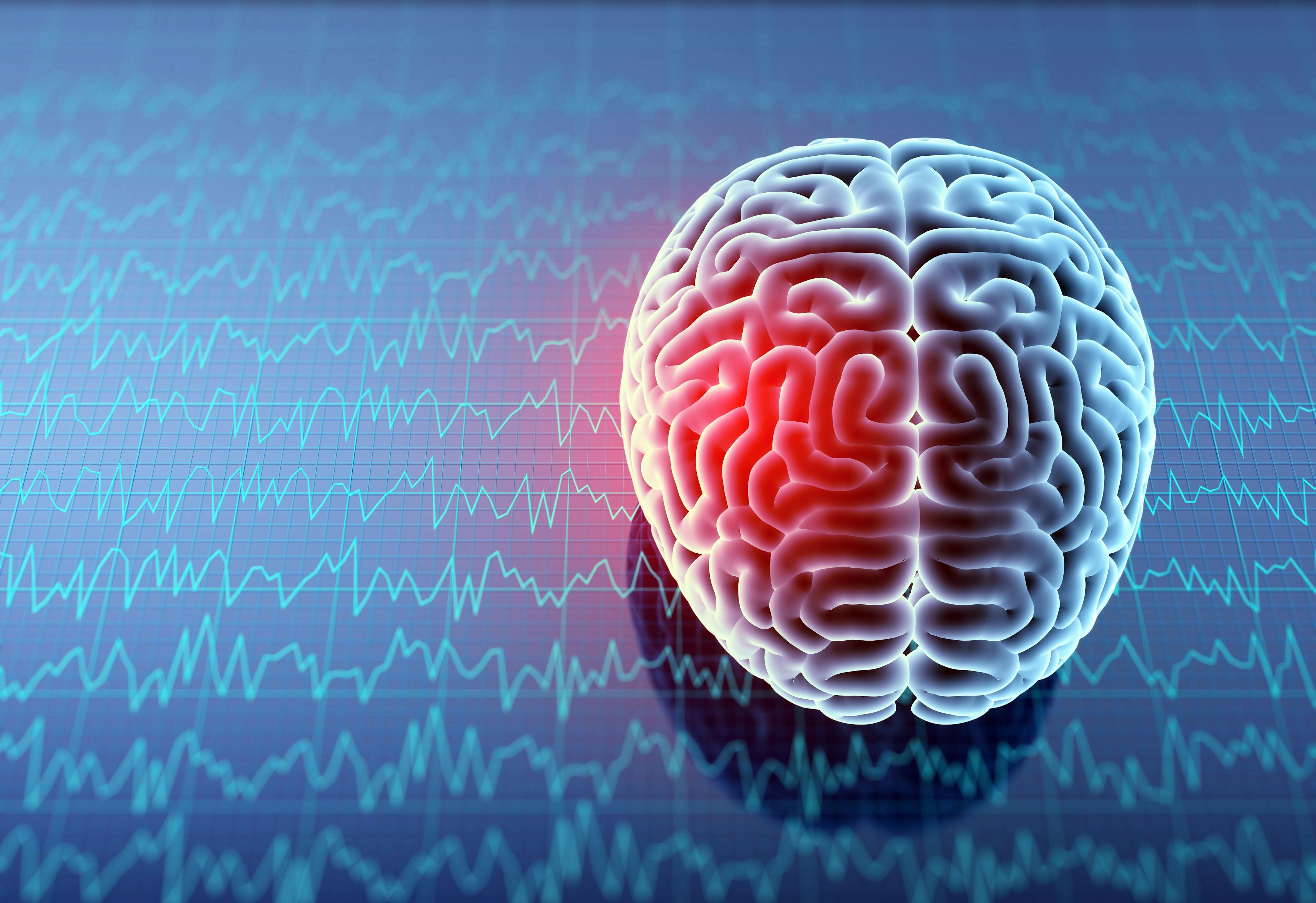 Headache area on brain X-ray, 3D illustration | Image credit: Iaremenko - stock.adobe.com