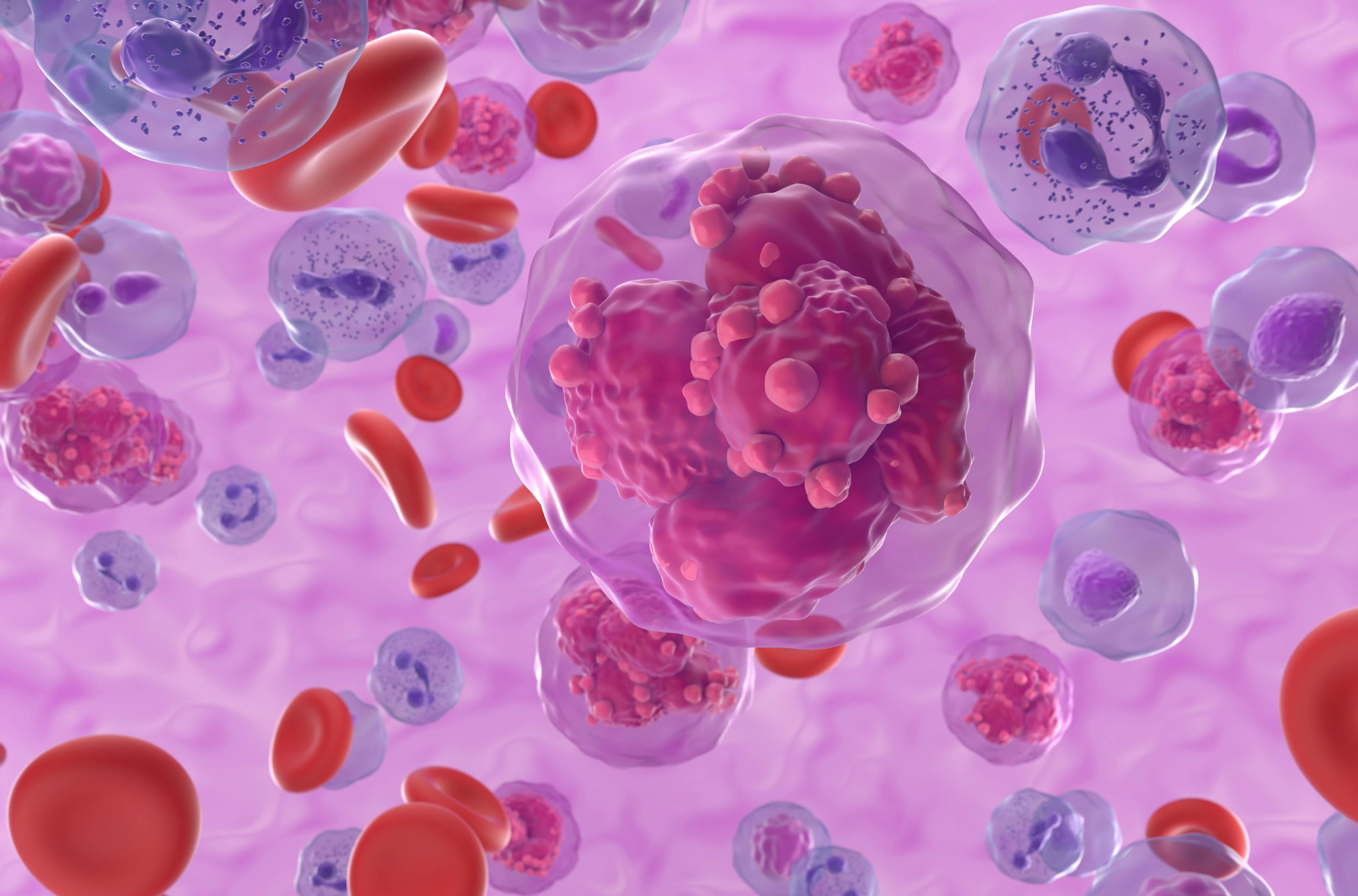 Acute lymphoblastic leukemia (ALL) cancer cells in the blood flow -- Image credit: LASZLO | stock.adobe.com