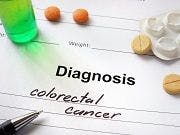 Experimental Drug Guadecitabine Proven Safe for Colorectal Cancer Treatment