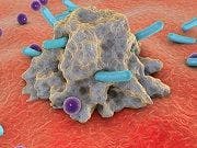 HIV Treatment With ART May Need a New Strategy