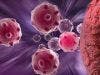 Combination Therapy Increases Overall Survival in Patients with TNBC