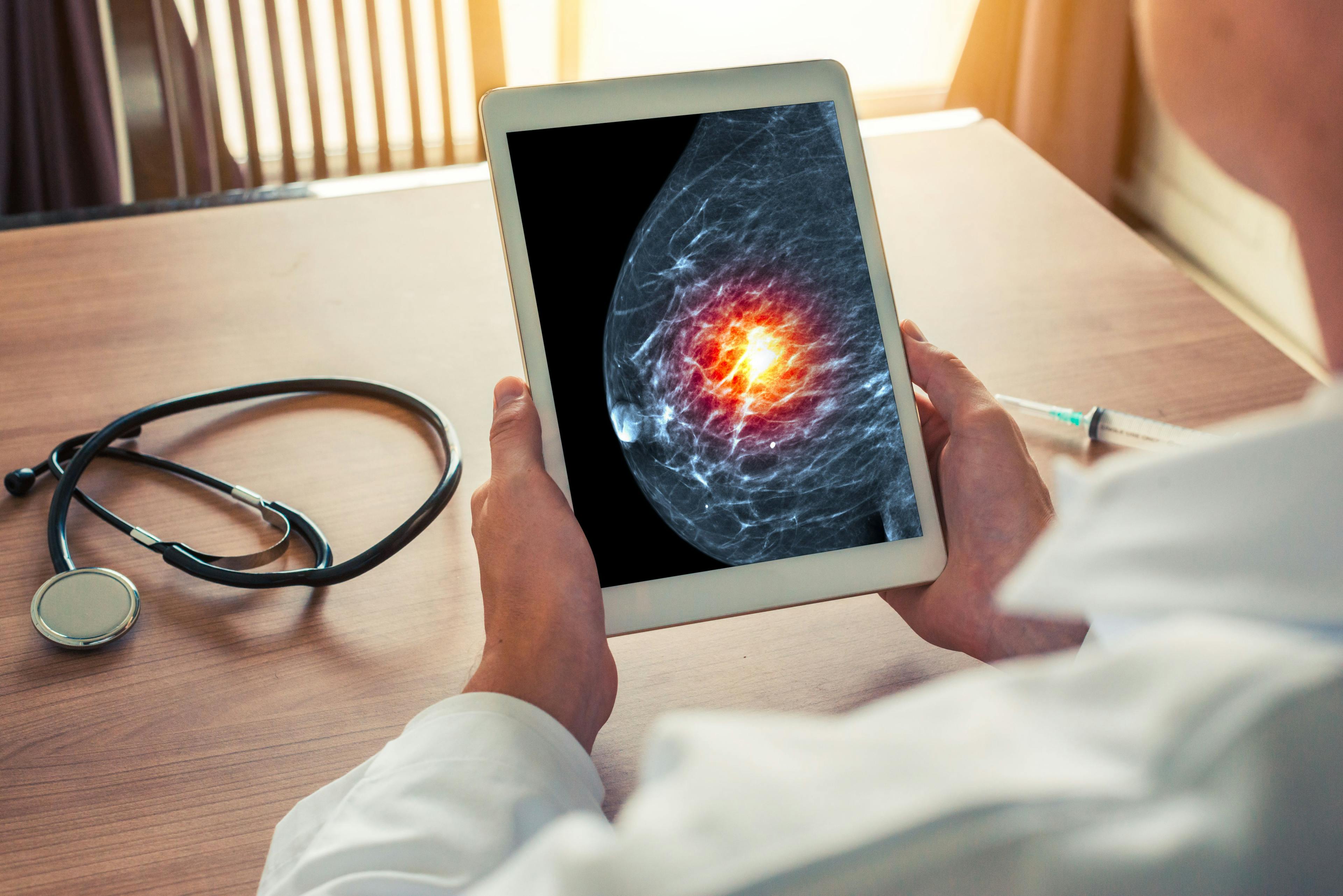 Doctor holding a digital tablet with xray mammogram skeleton. Breast cancer prevention. Credit: steph photographies - stock.adobe.com