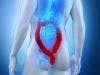 Increase Found in Early Diagnosis of Colorectal Cancer