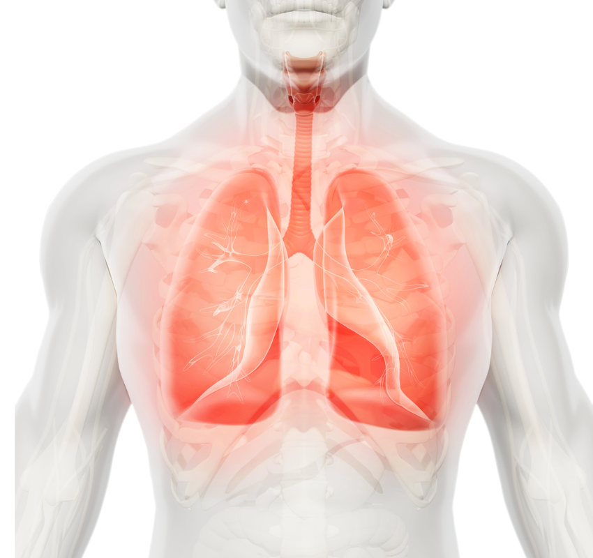 Case Study: Endobronchial Foreign Objects Can Present as Cough, Chest Pain