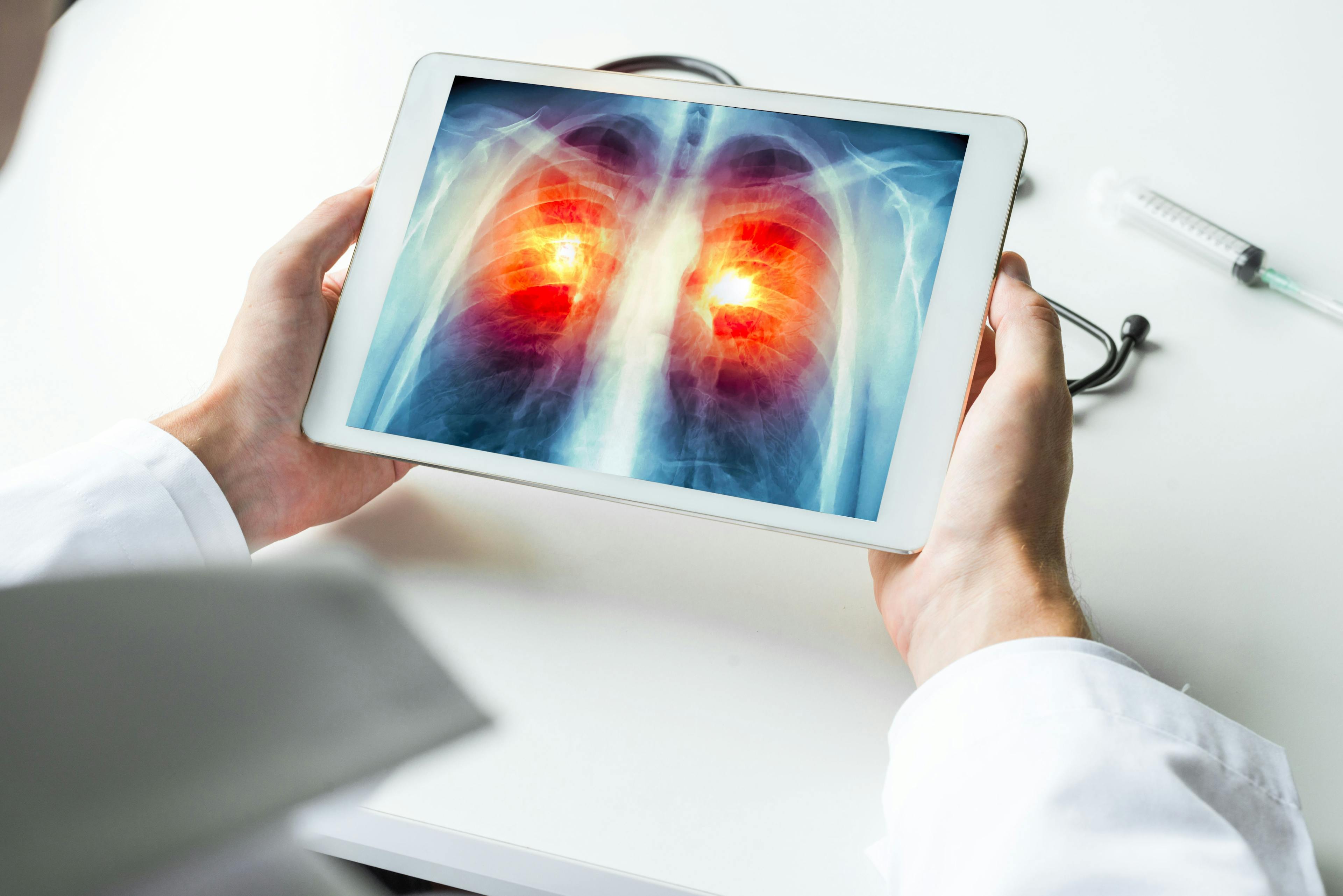 Health care professional viewing x-ray of lungs on a tablet