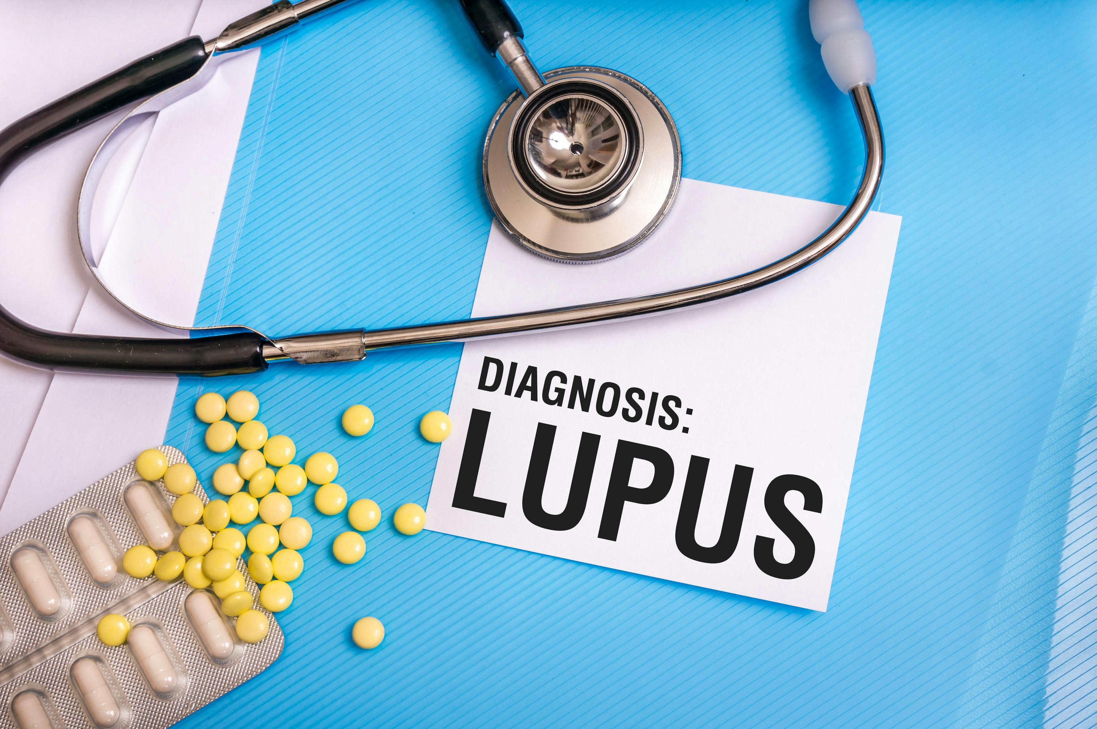 Lupus word written on medical blue folder with patient files | Image Credit: andriano_cz - stock.adobe.com