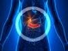 Rucaparib May Potentially Benefit Patients with Advanced Pancreatic Cancer