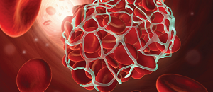 Use of Target-Specific Oral Anticoagulants for Venous Thromboembolism