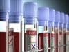 Trending News Today: Debunking the HIV Patient Zero Theory