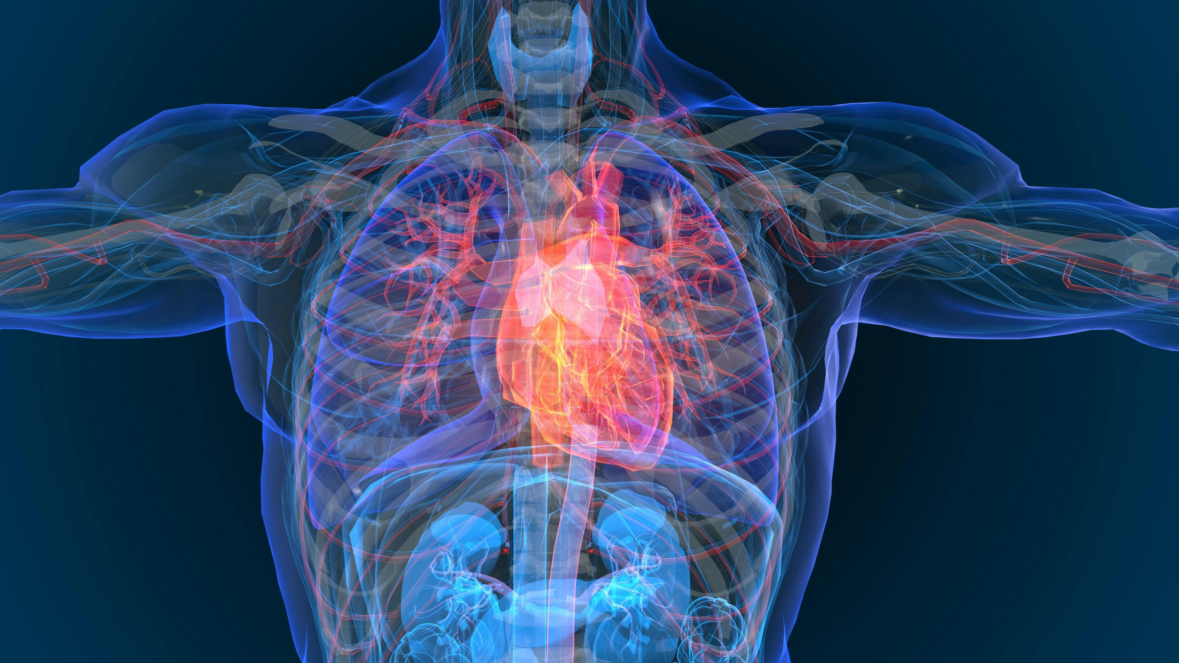 Phase 3 Trial Demonstrates Benefits to Mavacamten Treatment in Hypertrophic Cardiomyopathy