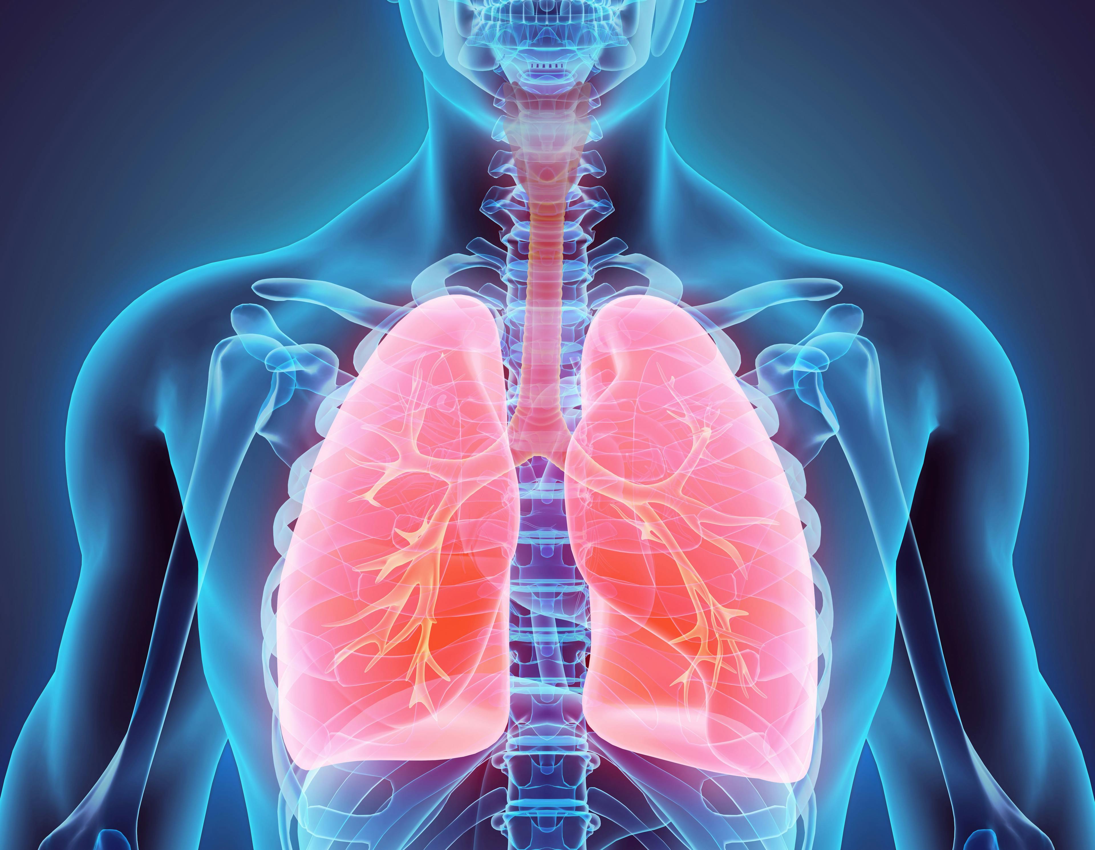 Mirati Therapeutics Releases Positive Results of Adagrasib for Treatment of NSCLC