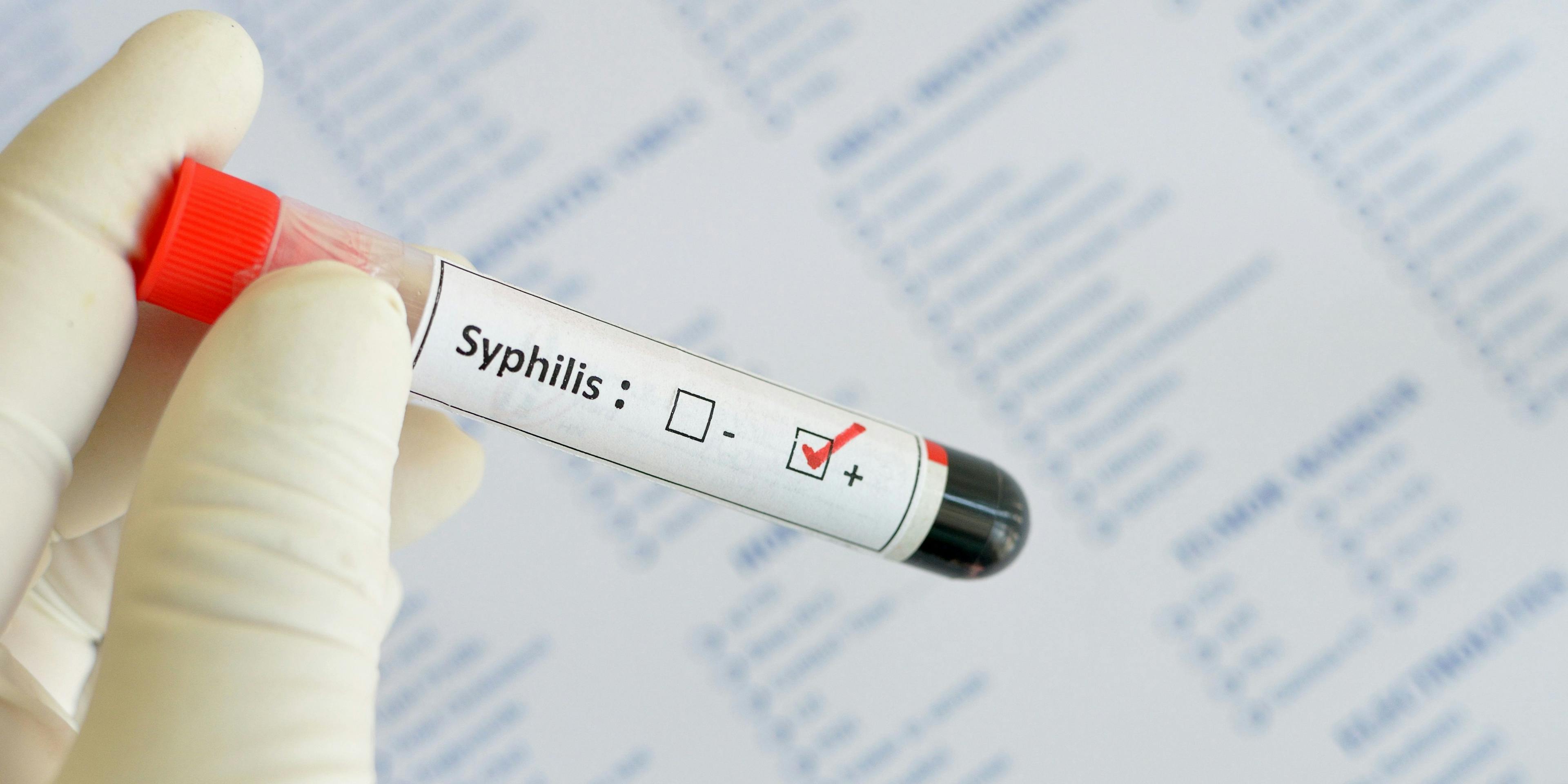 First-Ever FDA Waiver Expands Syphilis Test Availability 