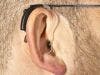 Sudden Hearing Loss More Frequent in Multiple Sclerosis