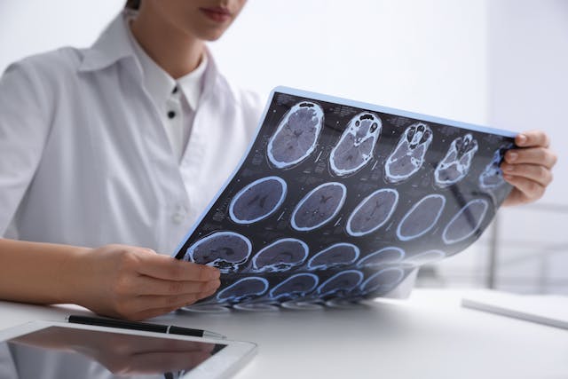 Doctor examining MRI images of patient with multiple sclerosis at table in clinic, closeup | Image Credit: New Africa - stock.adobe.com