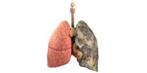 COPD and N-acetylcysteine: Questions Remain