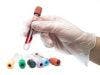 Fewer Opioid Treatment Programs Offer HIV Testing