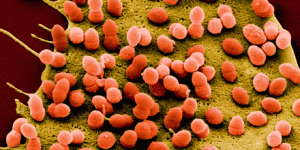 The Changing Picture of Streptococcus Pneumoniae