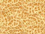 Positive Results Announced for Osteoporosis Drug