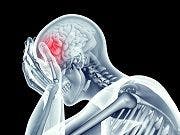 New Treatments for Migraines on the Horizon