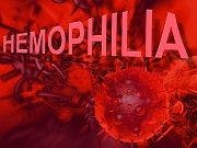 Hemlibra Gets FDA Approval to Treat Hemophilia A