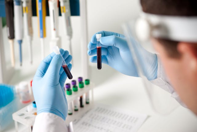 Lab scientist looking blood samples -- Image credit: Анна Ковальчук | stock.adobe.com