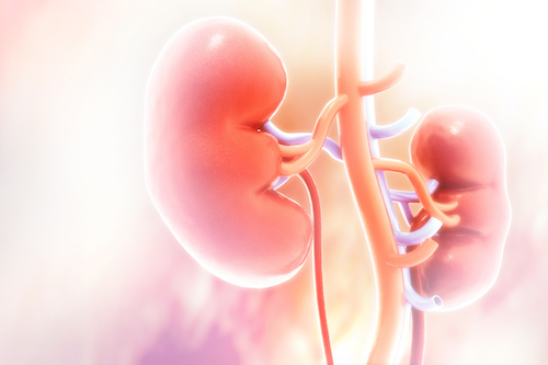 Study Examines Sex-Specific Disparity in Replacement Therapy for Kidney Disease