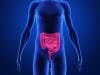Colorectal Surgery for IBD Carries Risk of Ischemic Colitis