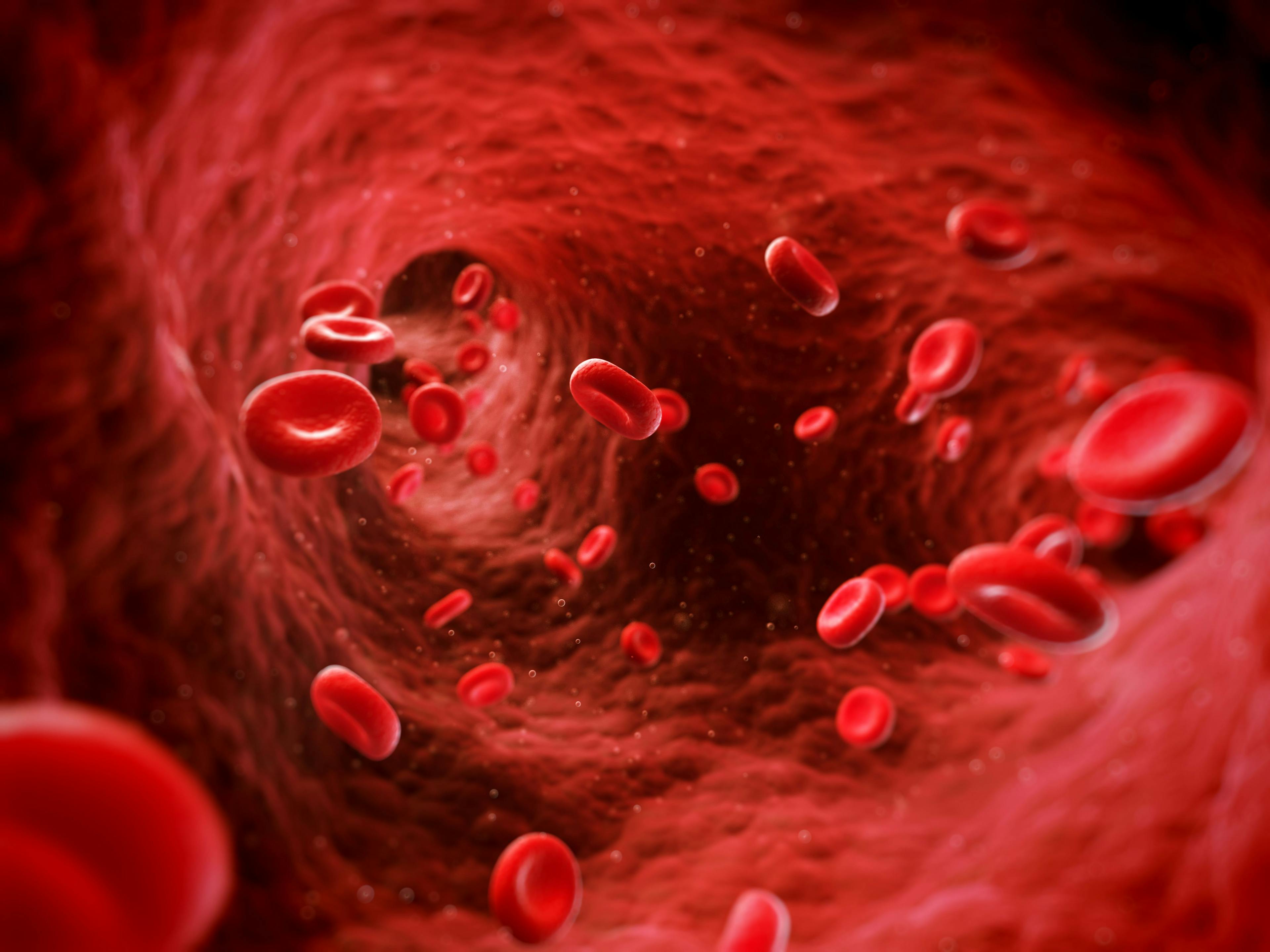 Expert: Phase 3 MEDALIST Trial Results Show ‘Red Blood Cell Transfusion Independence for Substantial Period of Time’ in LR-MDS