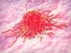 Switchable CAR T-Cell System Shows Promise in Pancreatic Cancer Treatment