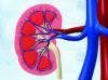 Investigational Drug to Treat Hyperkalemia in Kidney Disease Patients