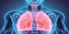 Novel Immunotherapy Combo for Lung Cancer Shows Promise in Early Trial