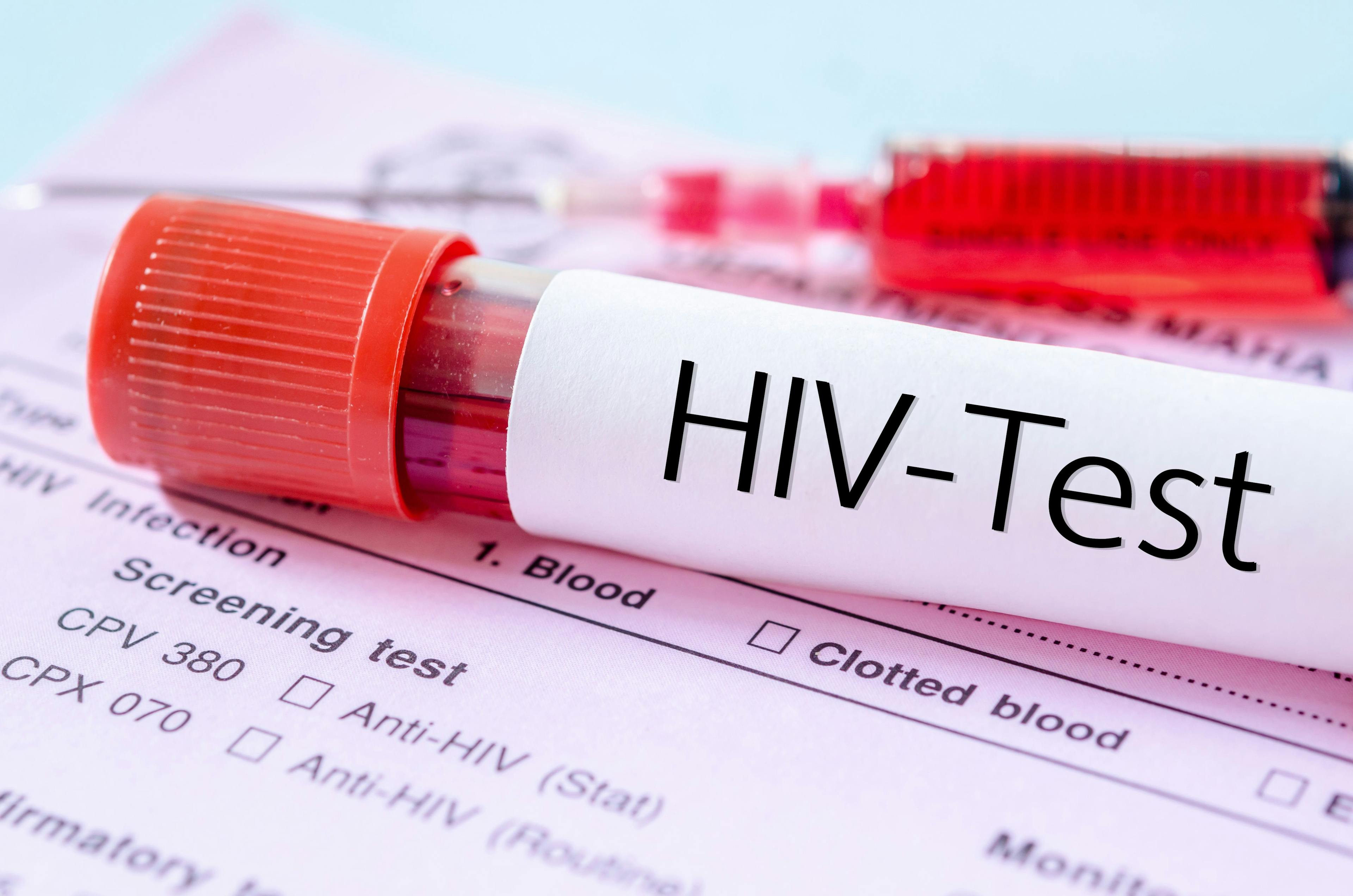 HIV test label on HIV infection screening test form. | Image Credit: gamjai - stock.adobe.com