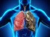 Targeted Drug Ineffective in Treatment of Early Stage Lung Cancer 
