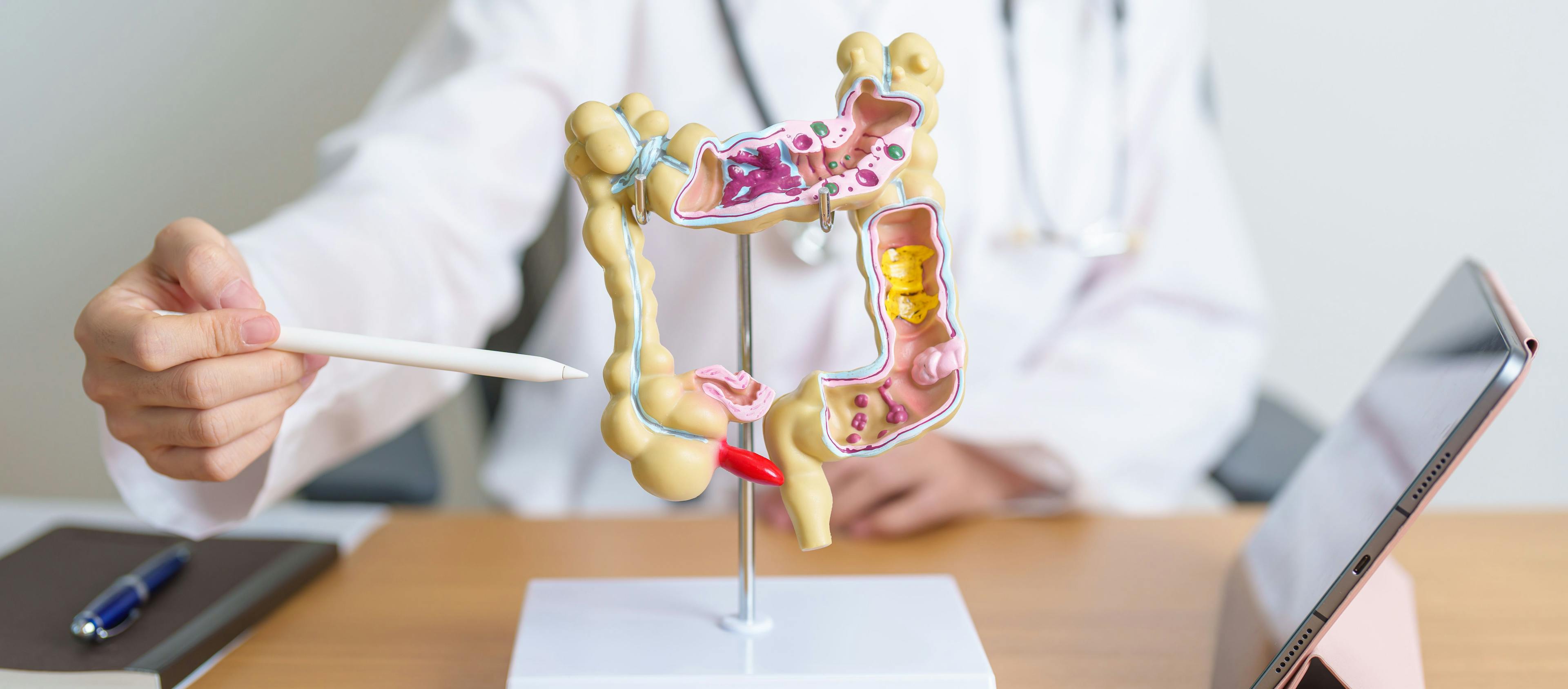 Health care worker presenting a model of the gastrointestinal system