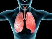Repurposed Cancer Drug Could Treat Severe Asthma
