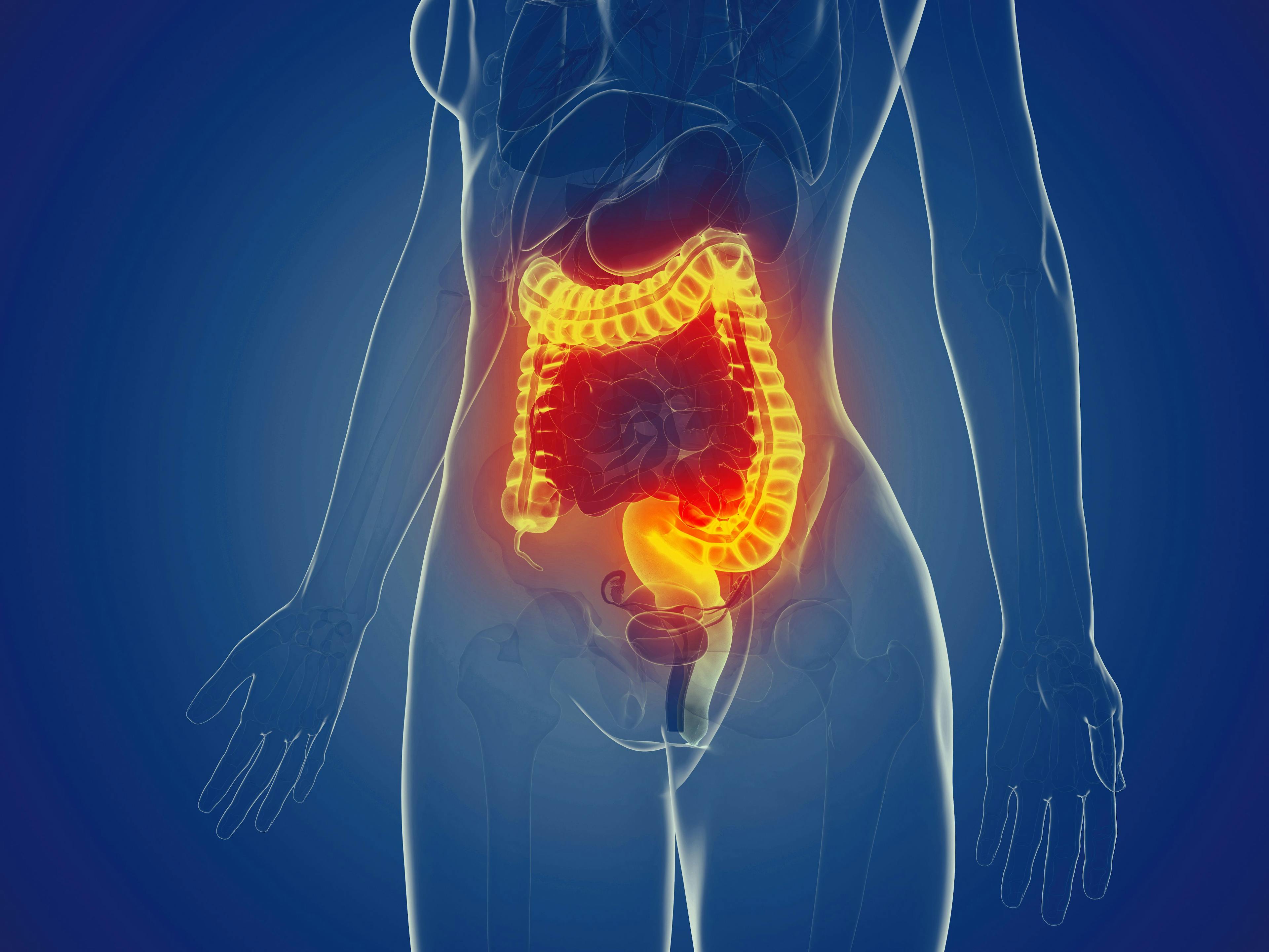 Medically accurate illustration of a womans large intestine | Image Credit: Sebastian Kaulitzki - stock.adobe.com