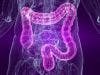 Superior Treatments Cause Drop in Advanced Colon Cancer Surgery