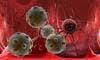 Authograft Treatment May Improve Multiple Myeloma Survival Rates