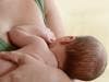 Breastfeeding May Delay Multiple Sclerosis Relapse Postpartum