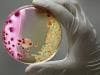 Dead Bacteria May Prove to be Effective Cancer Killer
