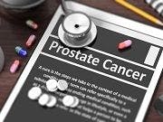 Current Prostate Cancer Treatments May Promote Relapse