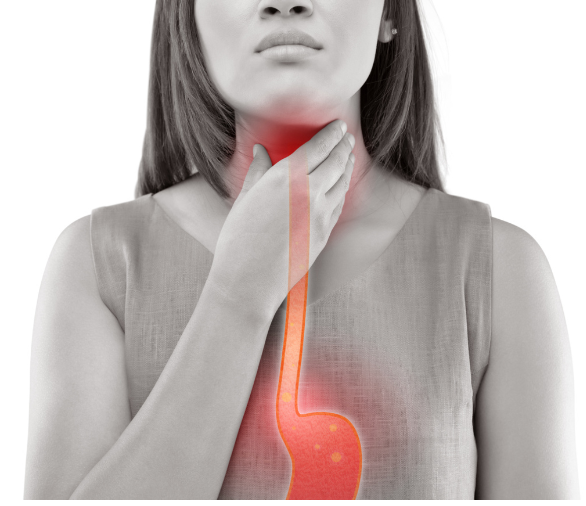Pharmacy Clinical Pearl of the Day: Gastroesophageal Reflux Disease 