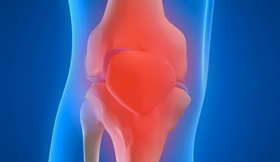 The Age of Targeted Osteoarthritis Therapy Begins
