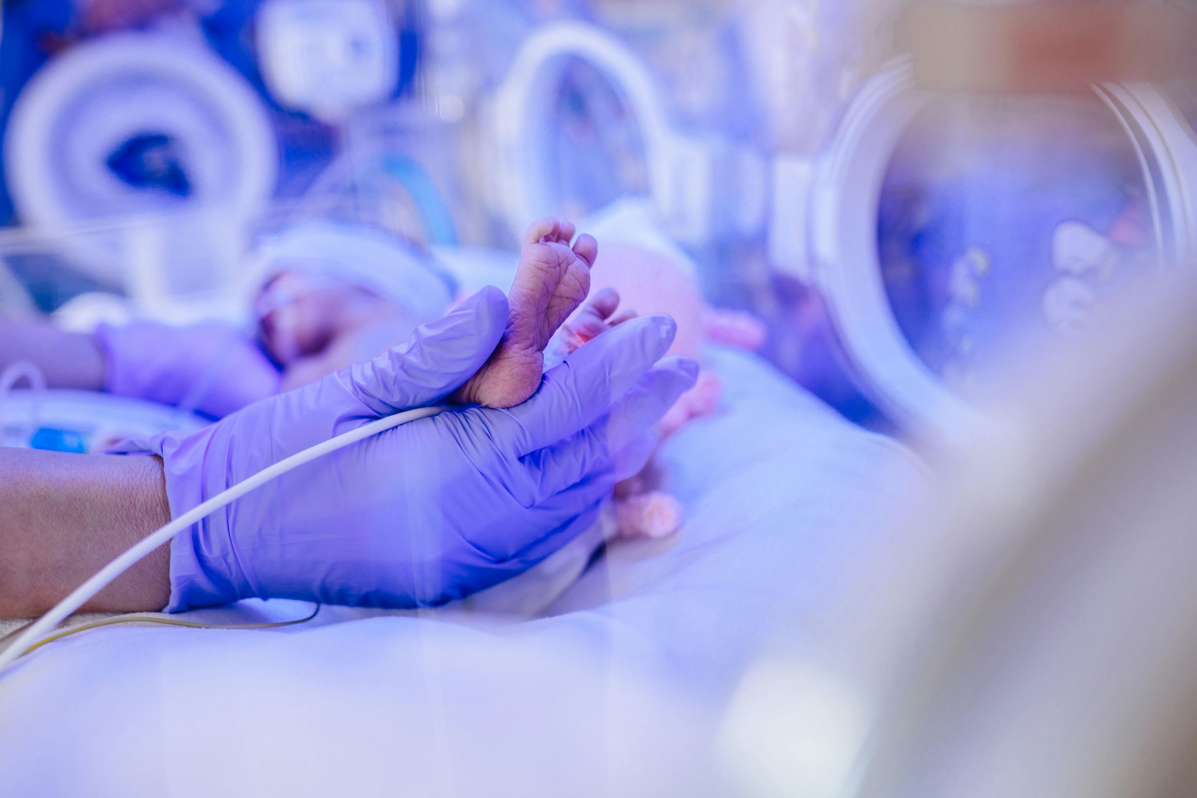Macro photo of doctor's hands and legs of a child. Newborn is placed in the incubator. Neonatal intensive care unit | Image Credit: Iryna - stock.adobe.com