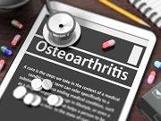 Osteoarthritis Treatment Should Align with Disease Subtypes