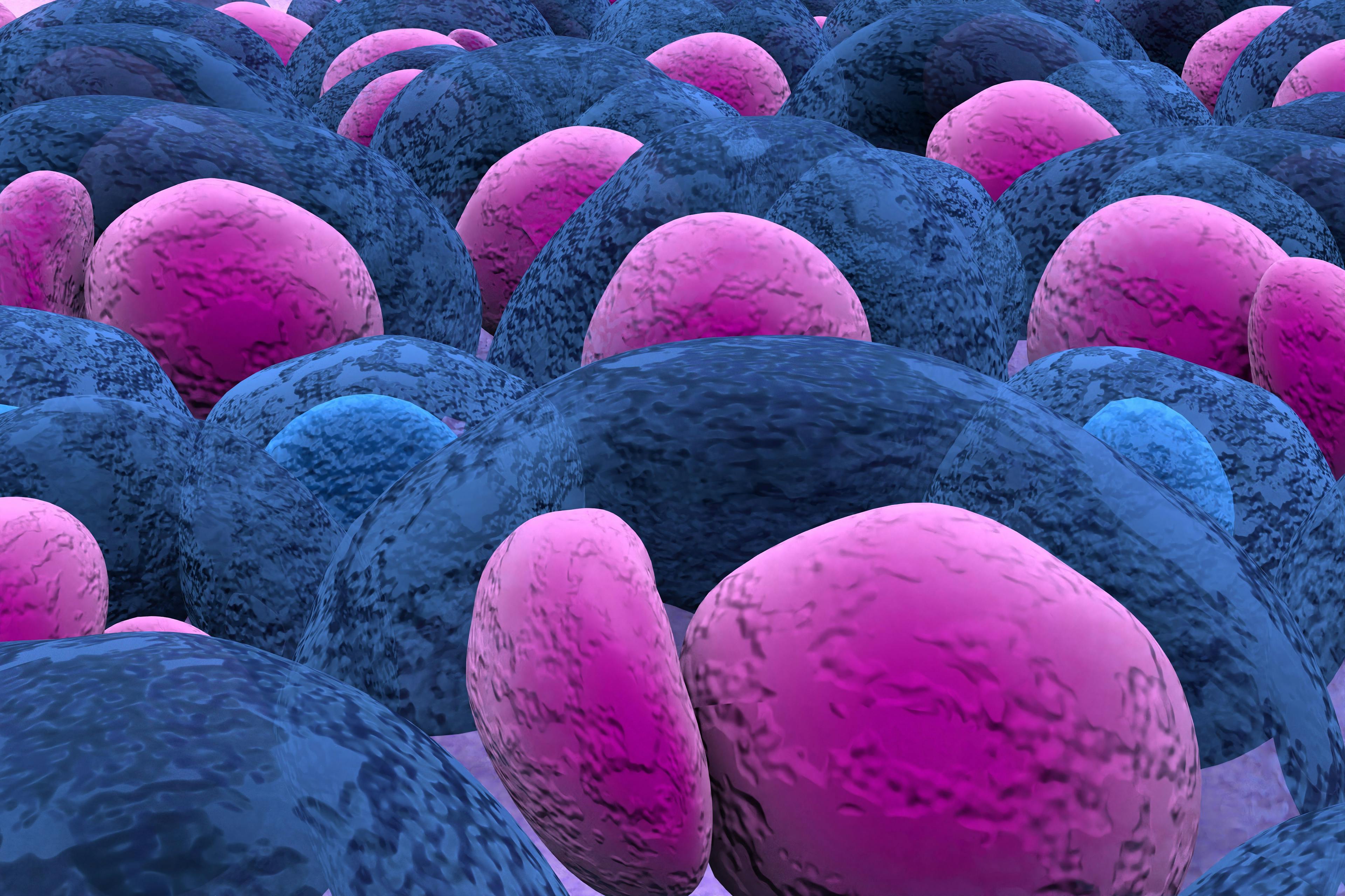 Multiple Myeloma multiplex leukemia cancer 3d color render illustration closeup.Credit: LASZLO - stock.adobe.com. 