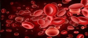 Updated Giroctocogene Fitelparvovec Study for Patients with Severe Hemophilia A