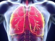 Severe Asthma Drug Shows Promise