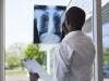 Afatinib Reevaluated for Added Benefit in Patients with Non-Small Cell Lung Cancer