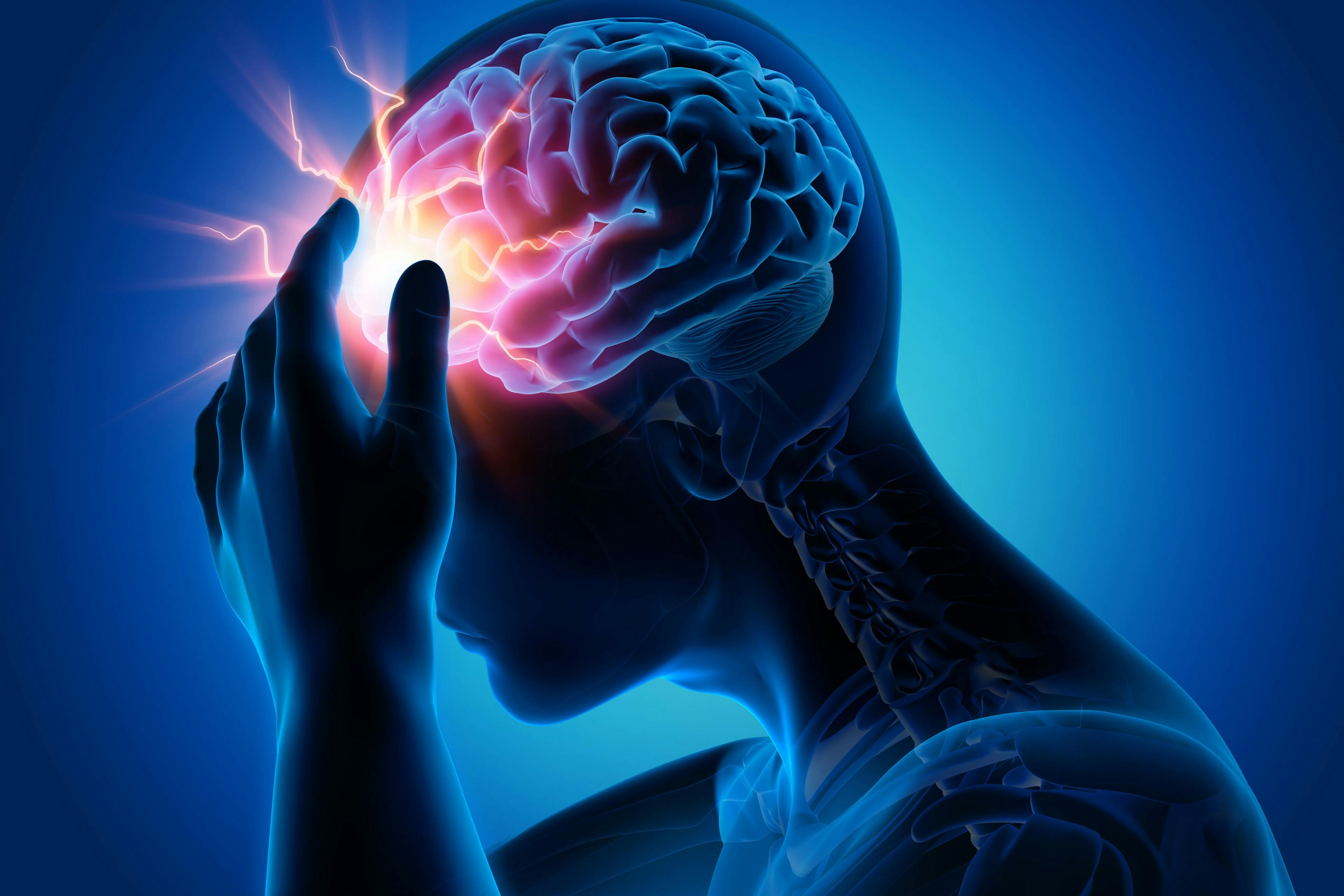 Migraine pain -- Image credit: peterschreiber.media | stock.adobe.com